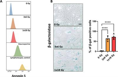 Immunological signatures from irradiated cancer-associated fibroblasts